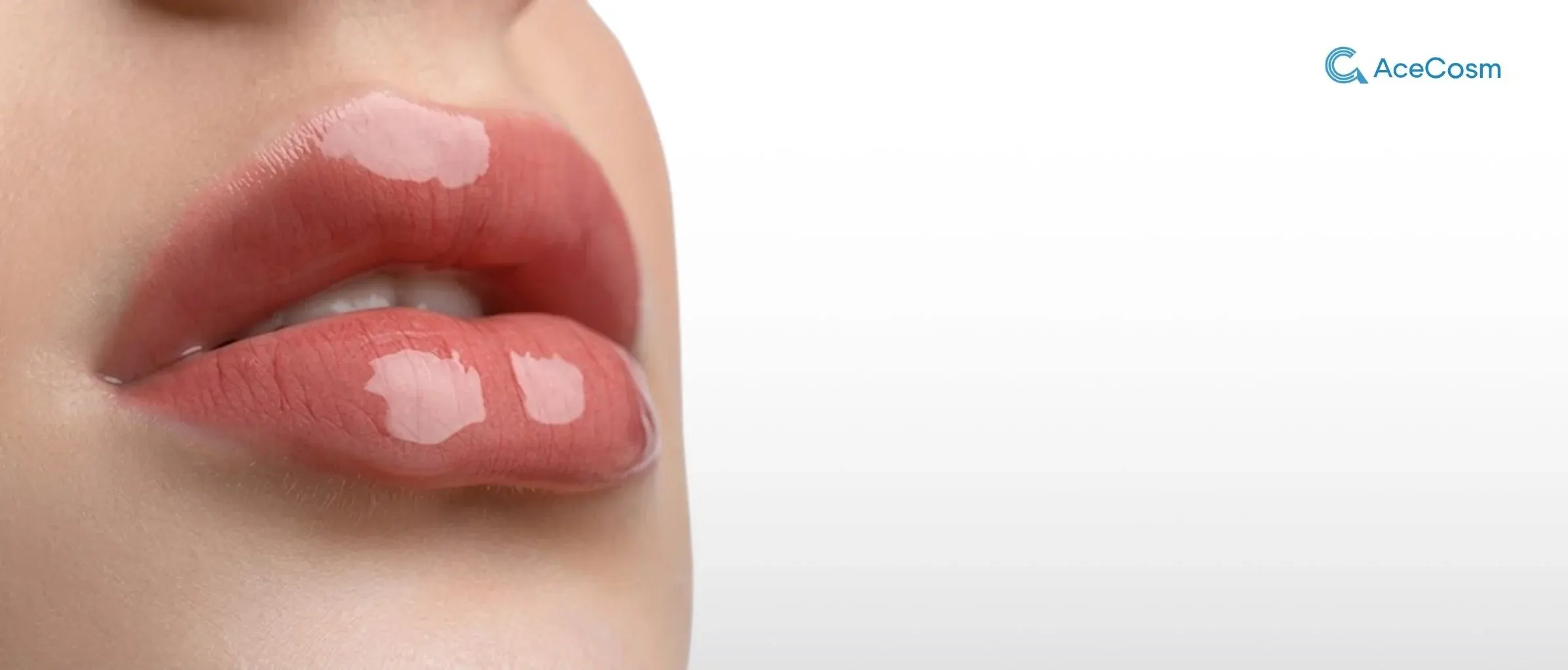 Dermal Filler