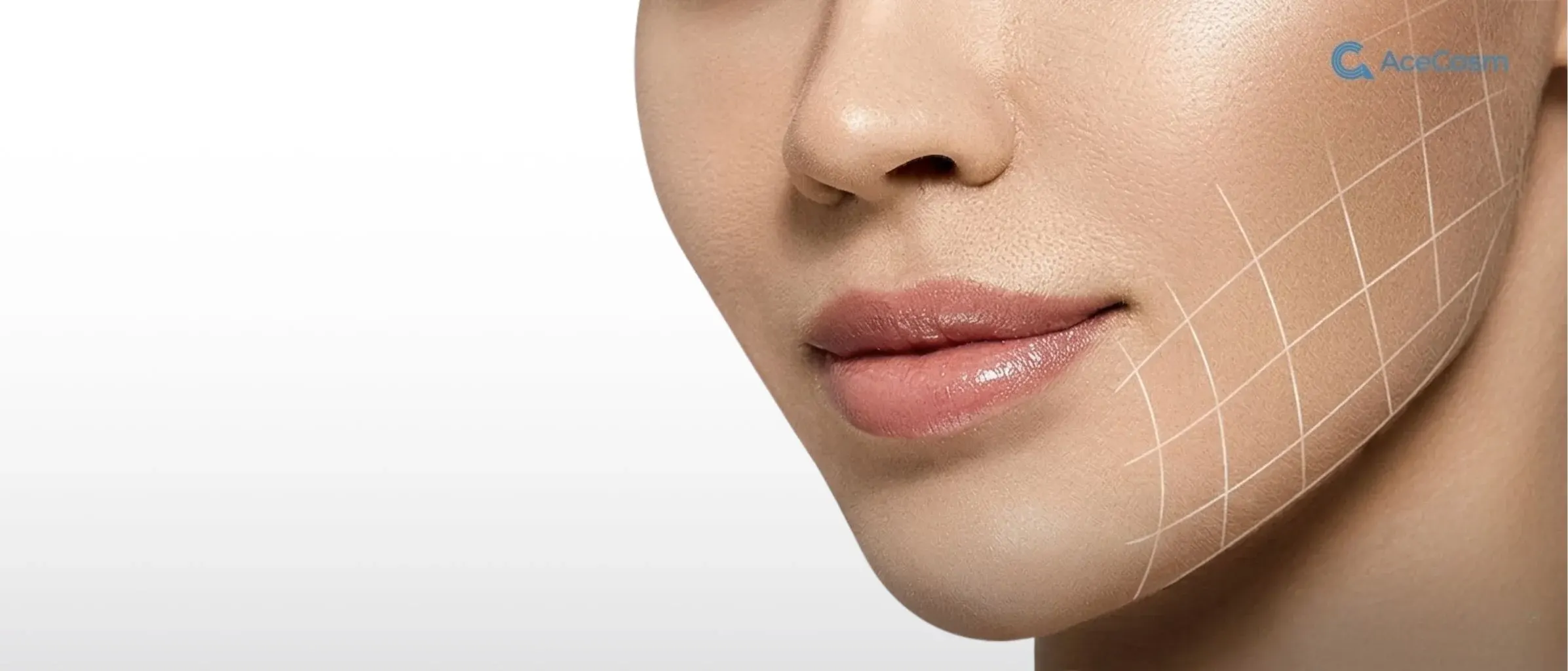 Face Lifting
